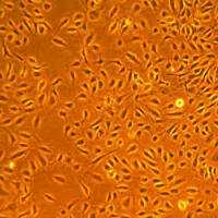 人冠状动脉内皮细胞Human Coronary Artery Endothelial Cells