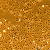 人肺动脉内皮细胞Normal Human Pulmonary Artery Endothelial Cells