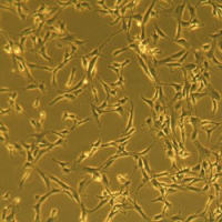 人大动脉平滑肌细胞Human Aortic Smooth Muscle Cells