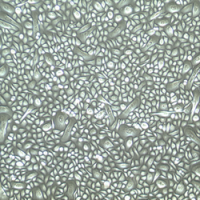 人阴道上皮细胞Human Vaginal Epithelial Cells