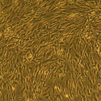 人肺成纤维细胞Normal Human Lung Fibroblasts