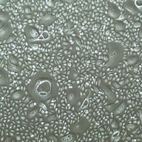 人膀胱上皮细胞-顶点Human Bladder Apex Epithelial Cells — Primary