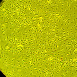 人皮肤微血管内皮细胞-成人Dermal Microvascular Endothelial Cells – Adult