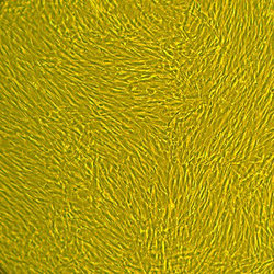 人子宫成纤维细胞Normal Human Uterine Fibroblasts