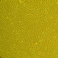 人子宫成纤维细胞Normal Human Uterine Fibroblasts