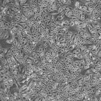人气管/支气管病变上皮细胞-原代Diseased Bronchial/Tracheal Epithelial Cells, Primary