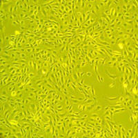 人主动脉内皮细胞Normal Human Aortic Endothelial Cells