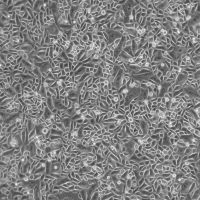 人小气道病变上皮细胞-原代Diseased Small Airway Epithelial Cells, Primary