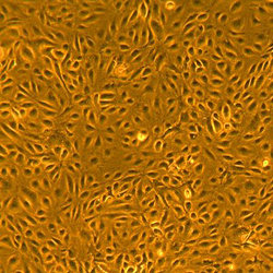 人皮肤微血管内皮细胞-新生儿Dermal Microvascular Endothelial Cells — Neonatal