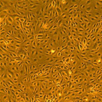人皮肤微血管内皮细胞-新生儿Dermal Microvascular Endothelial Cells — Neonatal