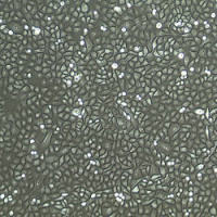 人精囊上皮细胞Human Seminal Vesicle Epithelial Cells