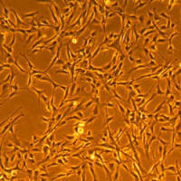 人冠状动脉平滑肌细胞Human Coronary Artery Smooth Muscle Cells