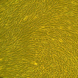 人子宫平滑肌细胞Normal Human Uterine Smooth Muscle Cells