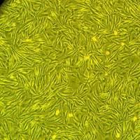 人皮肤黑色素细胞-新生儿,二代Epidermal Melanocytes — Neonatal, Secondary