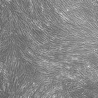 人前列腺成纤维细胞Prostate Fibroblasts, Human