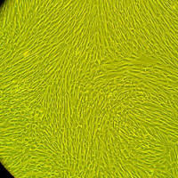 人膀胱上皮细胞Normal Human Bone Marrow Mesenchymal Stem Cells