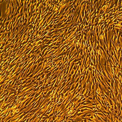 人皮肤成纤维细胞-成人Normal Human Dermal Fibroblasts — Adult, Primary