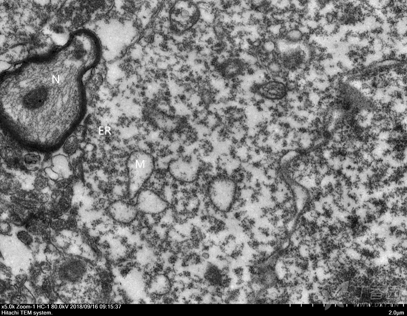有没专业的同道帮忙看下我标注的对不对,特别是内质网不会看,能否帮忙