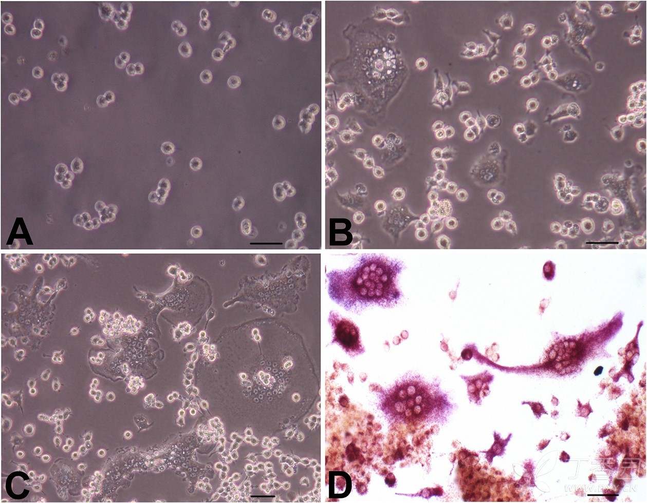 7 破骨细胞 trap染色