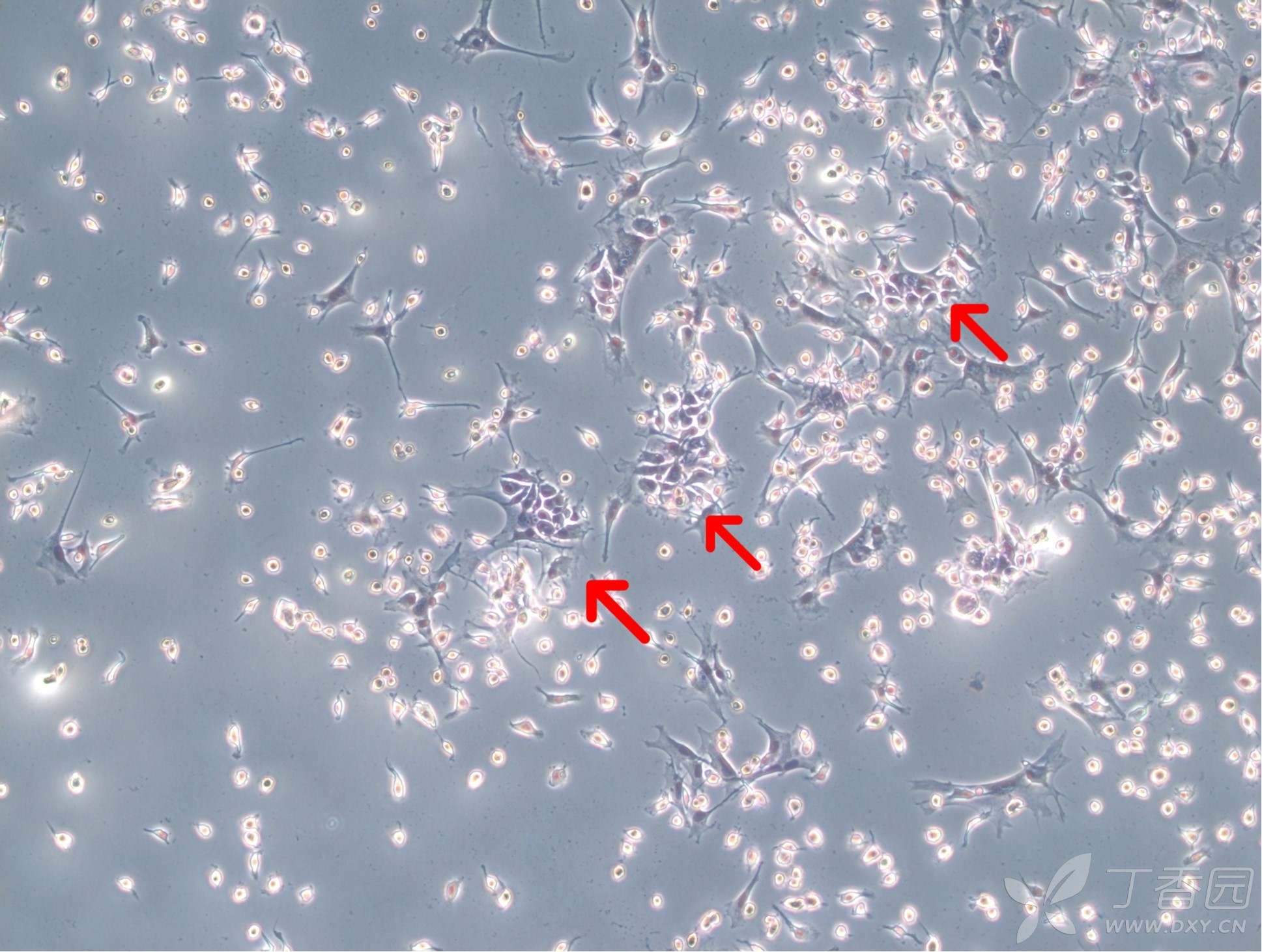 有没有大神养过破骨细胞啊