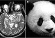 颅脑 MRI 里的大熊猫，你见过吗？