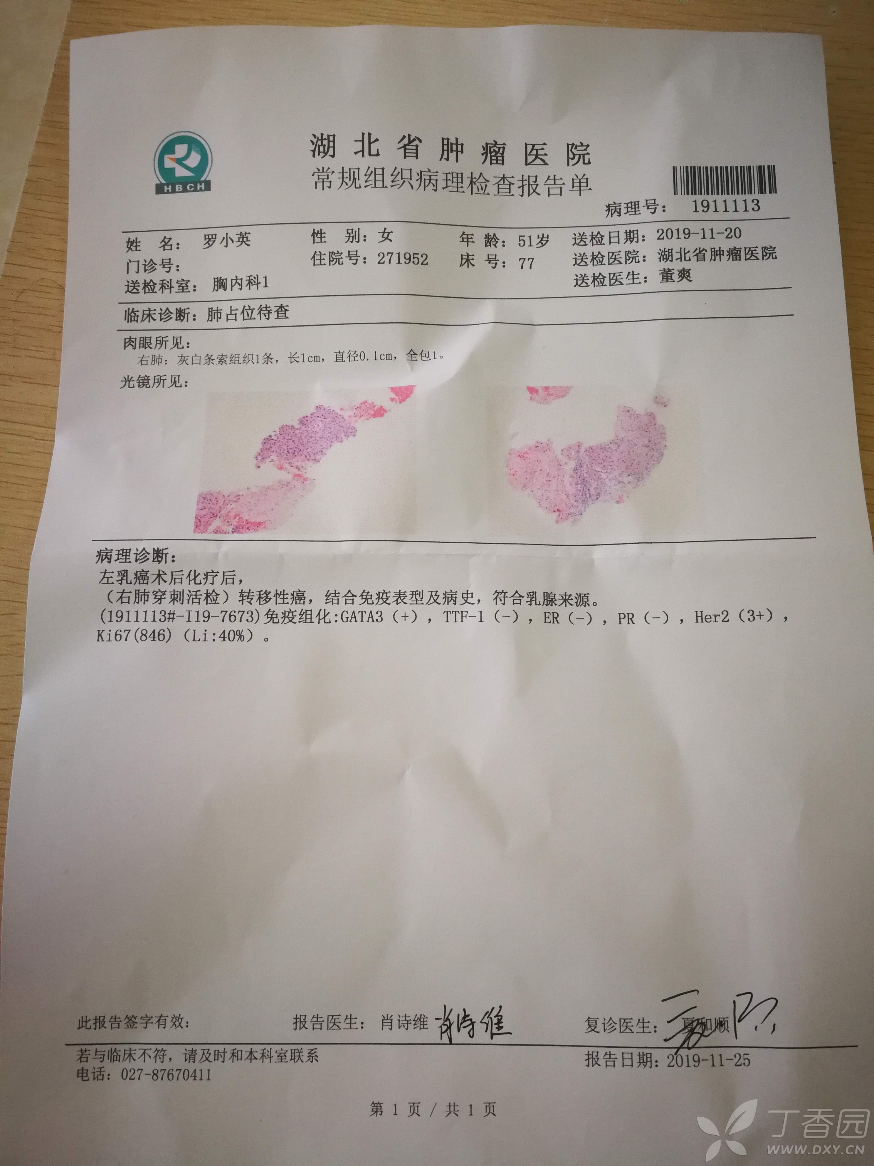 征兆已有胃癌便血说明什么原因_征兆已有胃癌便血说明严重吗_三个征兆说明已有胃癌便血
