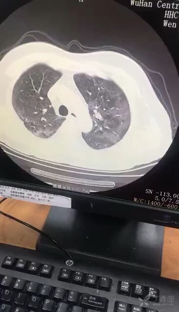 点击可编辑视频封面 preview