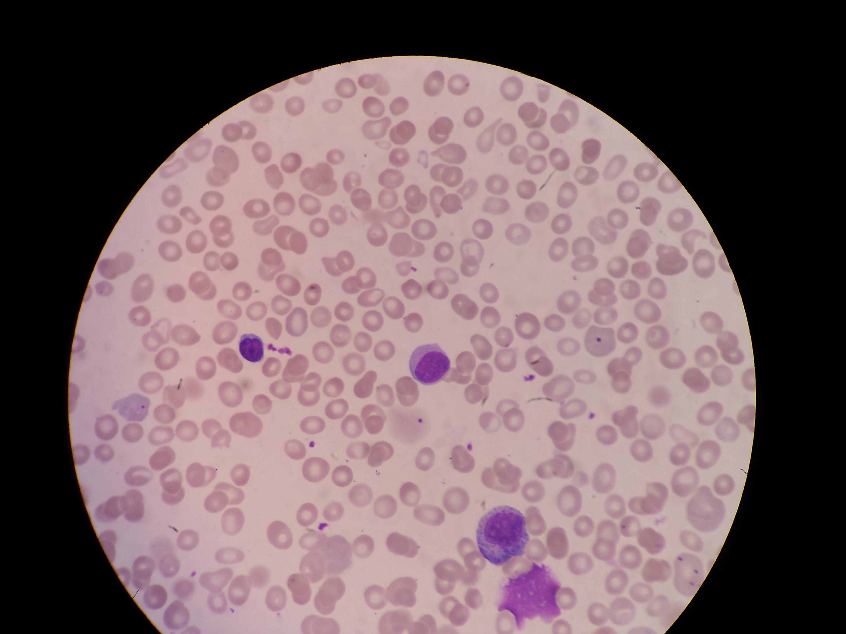 脐带间充质干细胞极其适合用于临床研究和应用