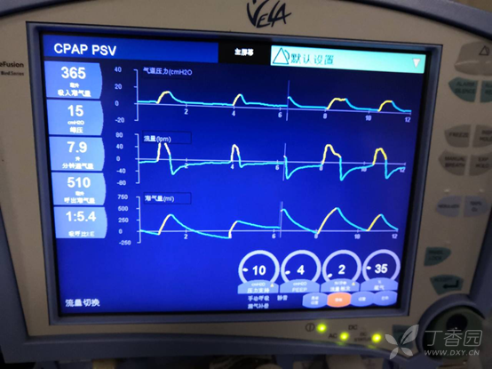 drager呼吸机界面图解图片