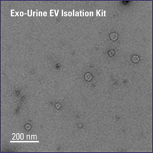 Exo-Urine™ EV Isolation Kit 尿液外泌体提取试剂盒 EXOU100A-1