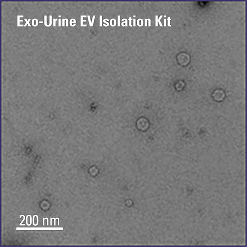 Exo-Urine™ EV Isolation Kit  尿液外泌体提取试剂盒 EXOU100A-1