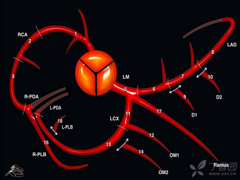cad-rads rs文章翻译 - 影像医学和核医学讨论版 -丁香园论坛