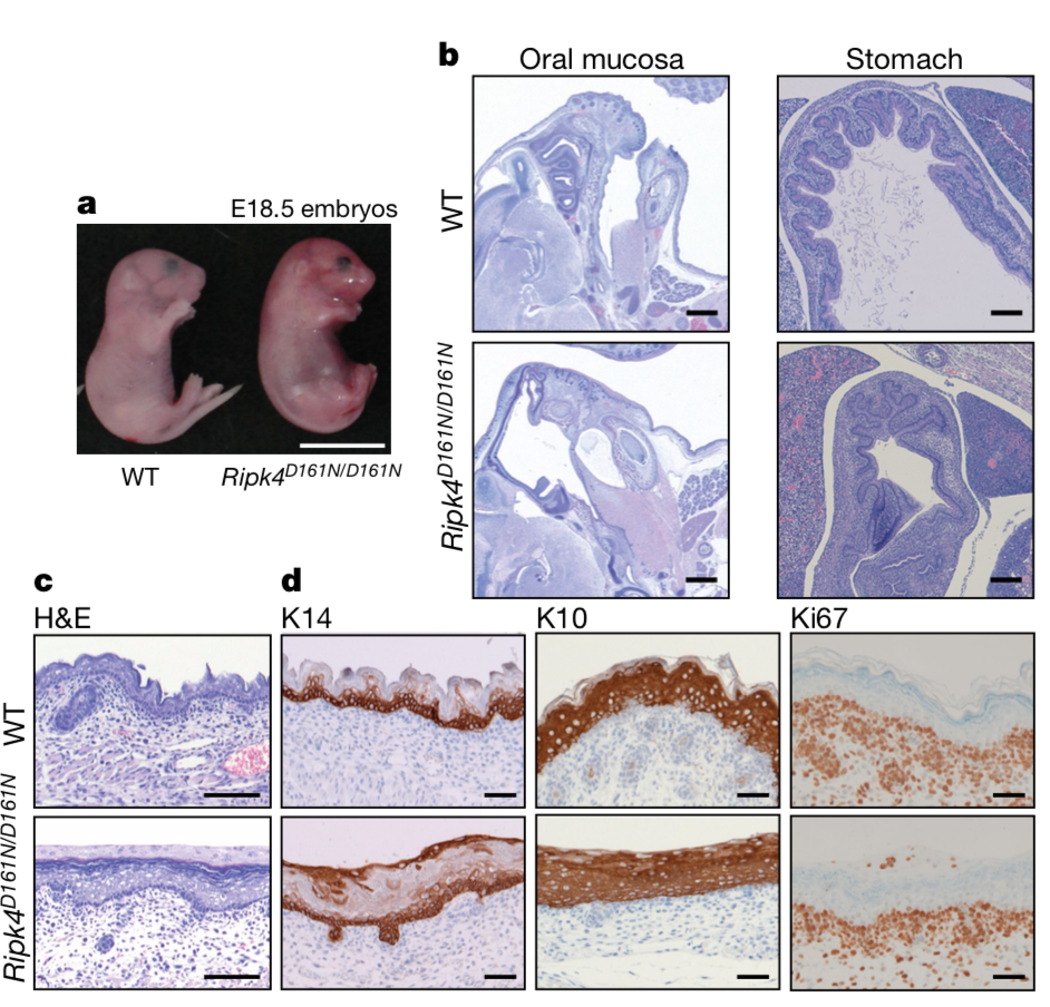 线性调控机制如何发现和研究？RIPK4-IRF6信号轴from Nature~