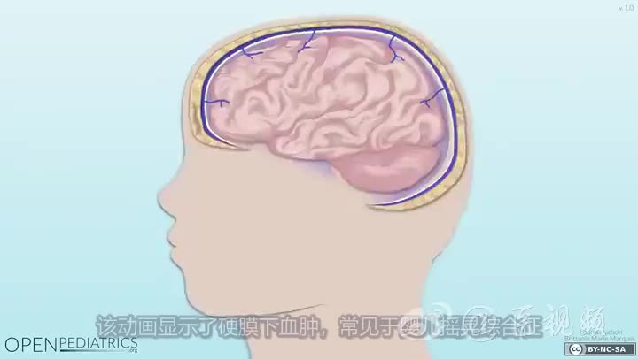什么算剧烈摇晃宝宝 3390815088260306749-66.jpg