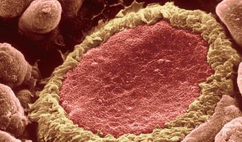 人急性单核细胞白血病细胞；THP-1规格