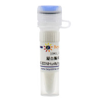凝血酶来源于牛血浆(40-300 NIH units/mg protein, Reagent
