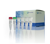 高效率RT-PCR：PreScript One-Step RT-PCR Kit(Dye Plus)