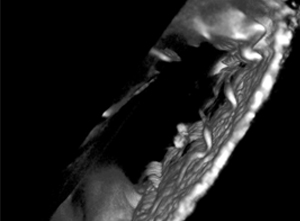 原位细胞3D切割成像平台-CellSurgeon