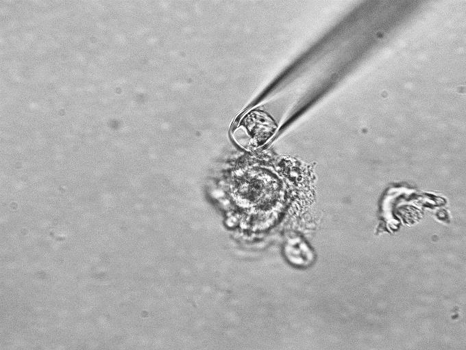 原位细胞3D切割成像平台-CellSurgeon