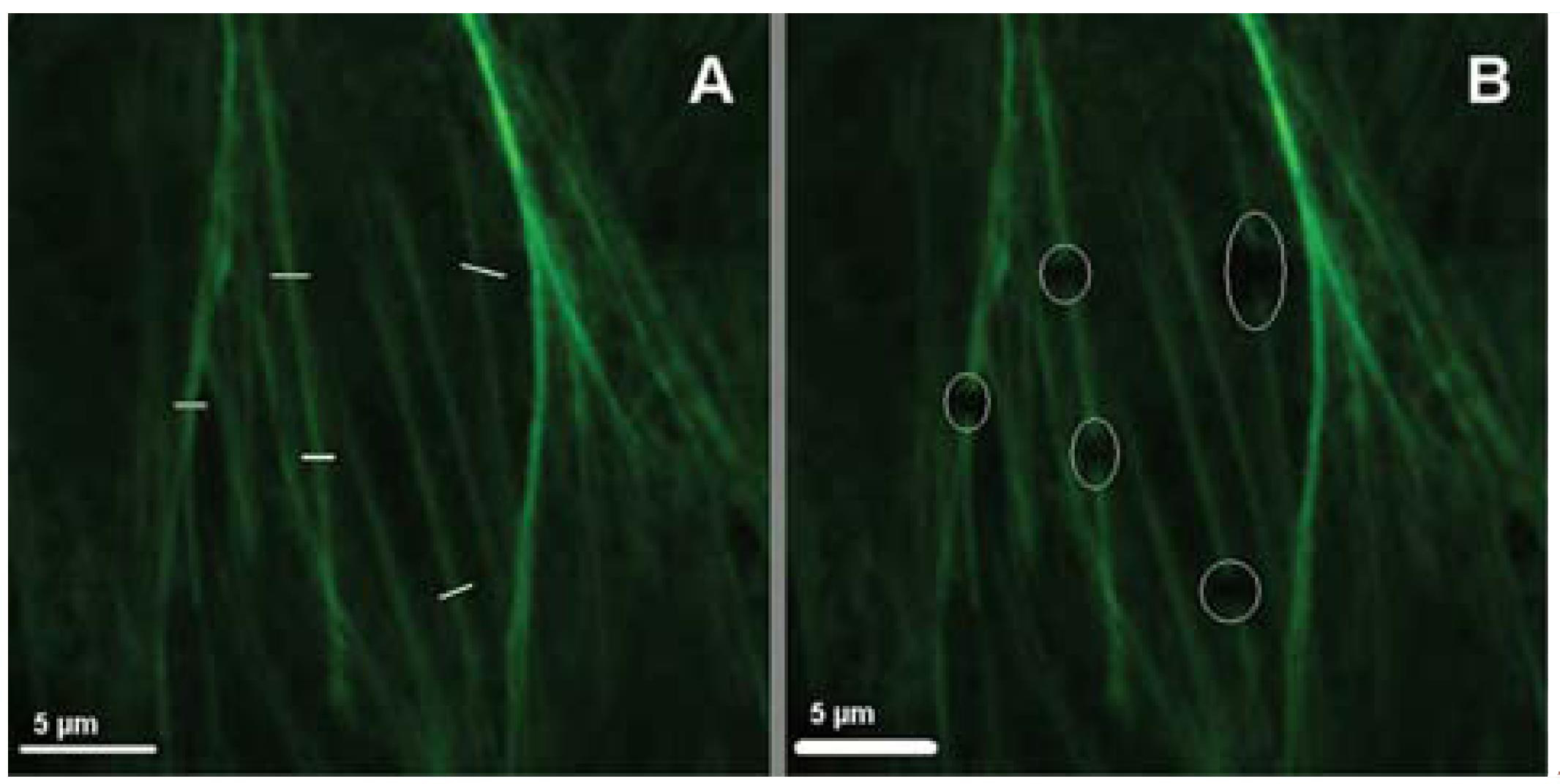 原位细胞3D切割成像平台-CellSurgeon