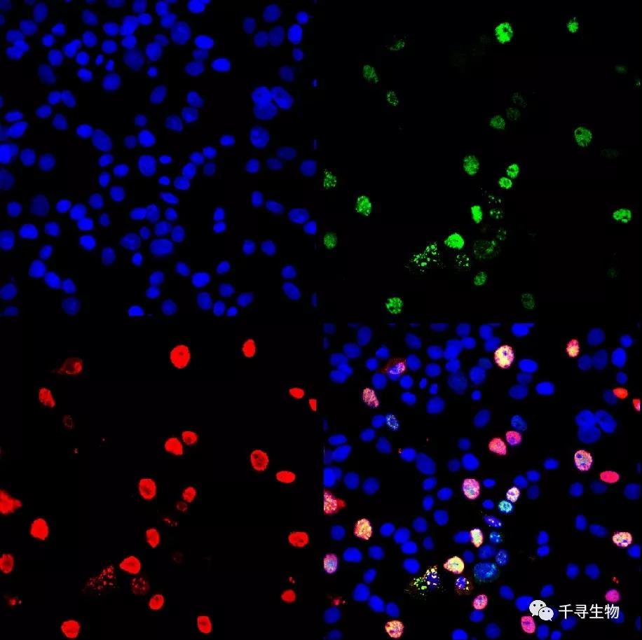 猪圆环病毒 2 型IFA实验不用再找进口单抗了！预告：ASFV抗原和单抗近期上市。