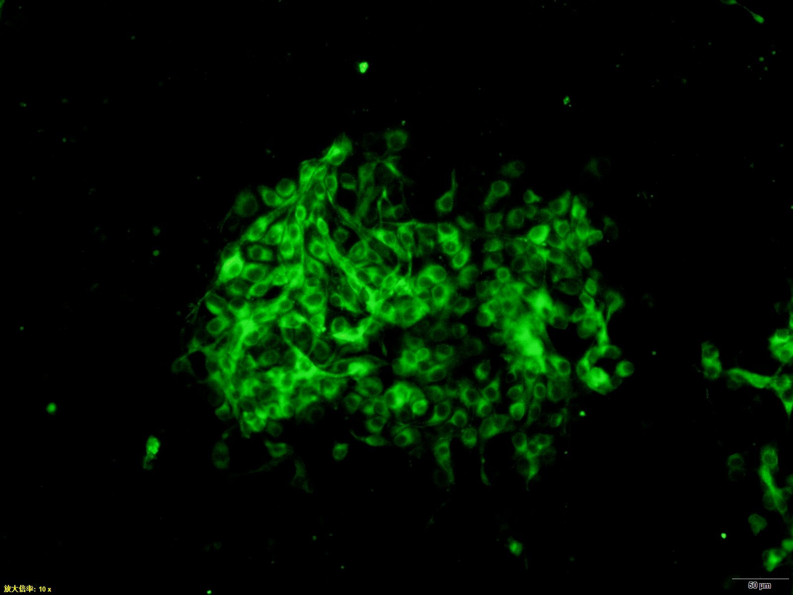 猪瘟病毒单克隆抗体上市！