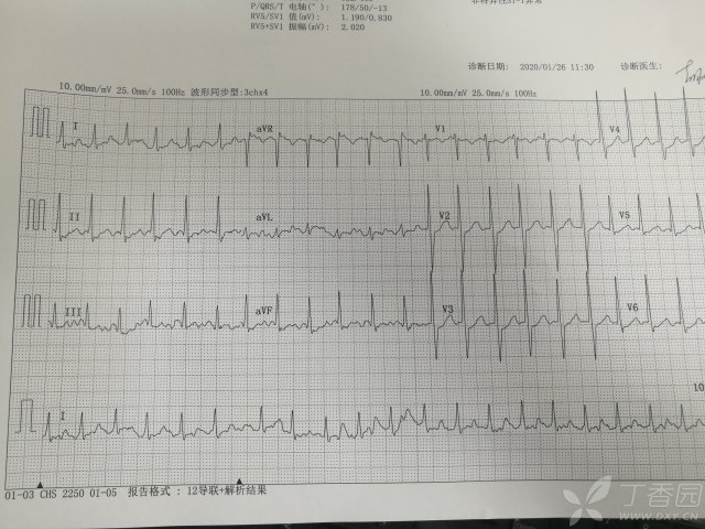 3393130062747657640-16w.jpg!w640