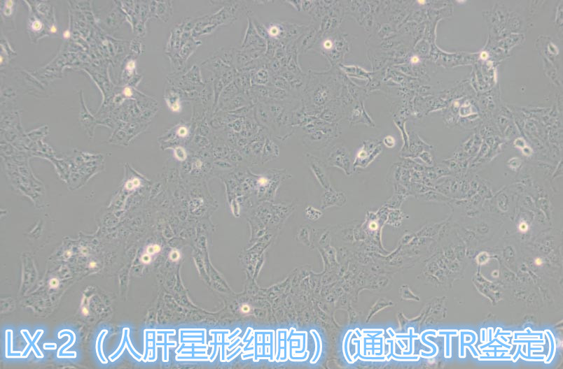 LX-2 / LX-2细胞 / LX-2人肝星形细胞价格,详情介绍-960化工网 – 960化工网