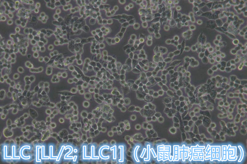 LLC [LL/2; LLC1]细胞 / LLC [LL/2; LLC1]小鼠肺癌细胞价格,详情介绍-960化工网 – 960化工网