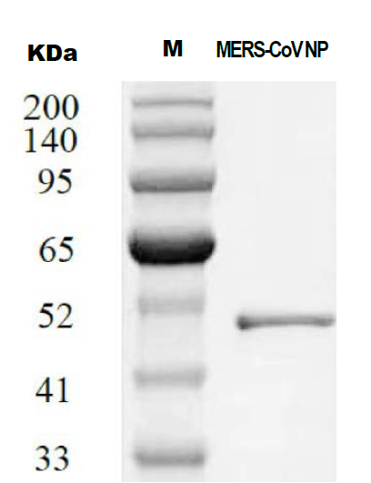 MERS 冠状病毒 核衣壳重组蛋白NP蛋白