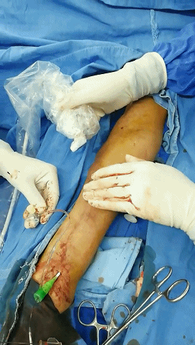 肾脏泌尿专业讨论版 血液净化 帖子详情 4.