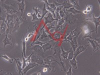 Hs 578T[HS-578T]乳腺癌细胞