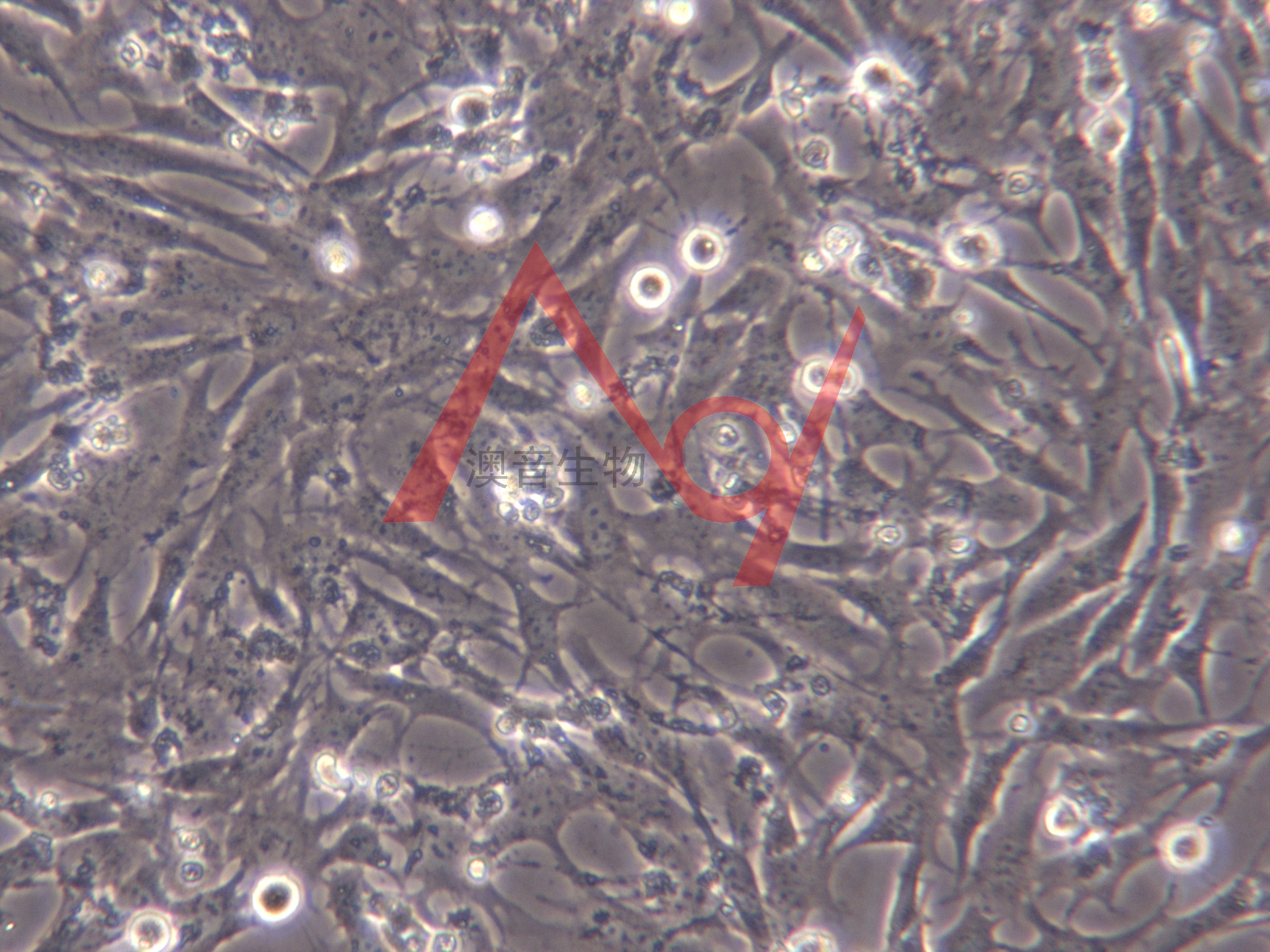 RGC-5【RGC5】小鼠视网膜神经节细胞株
