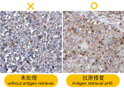 IHC问题排除(一)-6个IHC型态不佳该做的事
